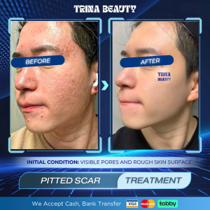 A man before and after treatment