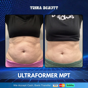 Ultraformer MPT in Abu Dhabi
