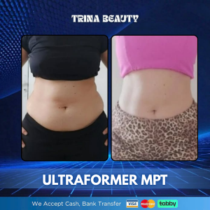 Ultraformer MPT in Abu Dhabi
